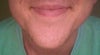 Front - Smiling