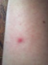 Arm bump, just picked if off so it's almost flat. Bad pic. See leg.