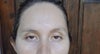 What my eyes look if not smiling or raising eyebrows