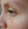 not a great pic but trying to demonstrate how hollow the eye is.