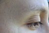 not a great pic but trying to demonstrate how hollow the eye is.