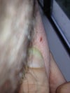 redness on right. I'm pretty sure I rubbed it afterwords, and that might explain the redness on the subsequent images.