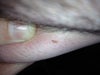 Another image of the mole. This is also before it seemed inflammed.