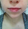 No shape to my upper lip.