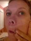 left side of face, easier to see when skin is pulled taught.  you can't see big lump, it just sticks out and looks bad when I smile.