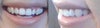 Teeth