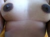 Frontal view