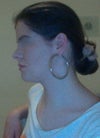 but I still feel that my jaw line is a bit manly and I would like to round it a bit more I was thinking about a chin reduction ore cheeck fillers, ore chin narrowing with filler they always seem to make the face more rounder in a after pictures with those procedures