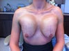 POD #4 - Frankenboobs aka Spongebob Squareboobs