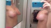 3 weeks post BA