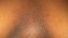 Skin directly between breasts