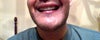 Retracted lower lip when laugh-like gesture.