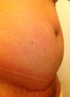 Hard and fluid filled belly.  36" -- 8" more than normal -- 8/15/12