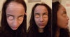These are 3 photos that show the high hairline, the odd cowlick.