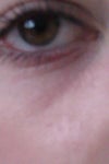 gross eye lines