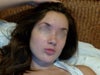This is me before starting Retin-A, a couple weeks ago.