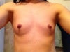 Frontal View