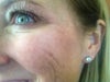 Close up - ugh!