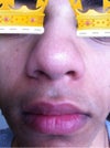 close up, asymmetry visible