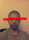 You can see my lips are also looking assymetrical cause of the deviation