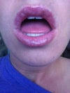 whiteish clear bumps