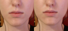 Before (left) After (right)