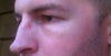 Swollen? or too much product?