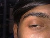 right eye