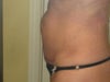 26 days after TT