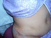 bruised side (right)