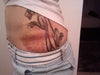 Bruising on other side but more spotty and not as dark