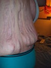 close of of same side,the other side if my body is the same
