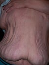 front side of abdomen from naval to breasts