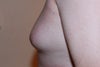 size of my breasts