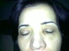 now  when the corner of me eye swollen
