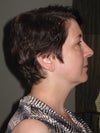 right side view