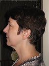 left side view
