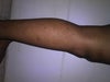 This is a side view of my leg.