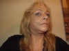 With make-up to cover bruising, Day 18