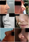 I am still trying to figure out what the little groove/dent on the tip of my nose is. If anyone knows, please leave a comment about it!