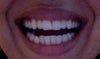 teeth open