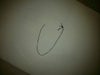 During the scar revision, Dr. Hwang removed a nylon suture with knots near my left ear