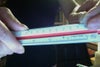 It is a 9cm long nylon suture which adds to the other nylon sutures which were buried over my head, ear, and face, including the one right above my left eye.