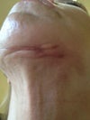 Chin