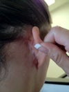 Right ear back