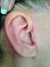 Right ear front