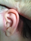 Left ear front