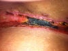 Right side above hip