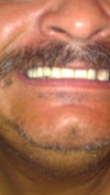 smile
