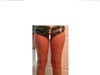 Sorry for the punctuation in the body of this message, only had so many letters and too much to say :)
The Dr. said her took out 1.5 lbs from my legs